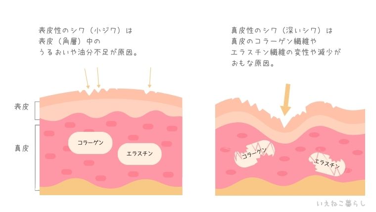 表皮性のシワと真皮性のシワ　イラスト