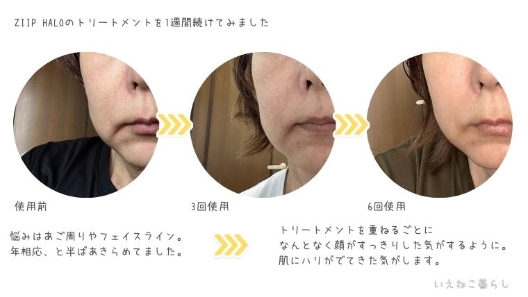 「ZIIP HALO」1週間使ってみた